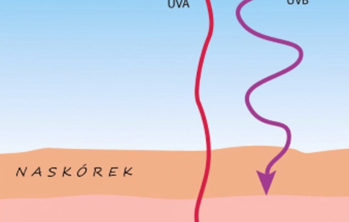 Filtry UV – konieczna ochrona latem cz.1