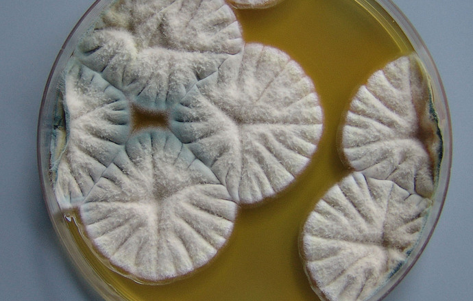 Staphylococcus aureus i Clostridium botulinum- morfologia i identyfikacja