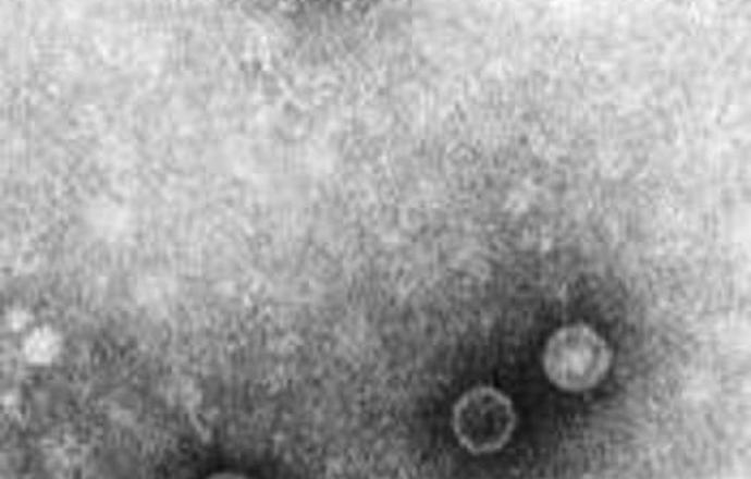 Co nowego w sprawie polio?