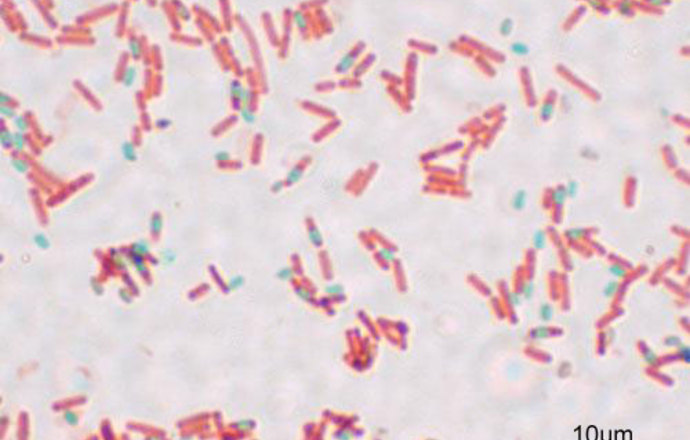 Bakteriocyna Bacillus subtililis- nowa perspektywa walki z zakażeniami stopy cukrzycowej
