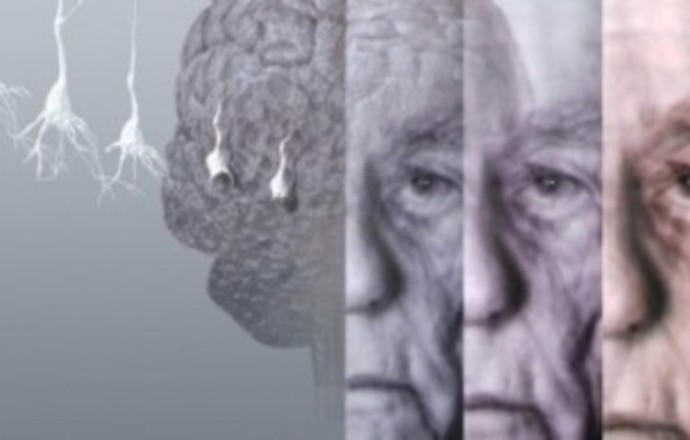 Podsumowanie roku 2013 w zakresie doniesień naukowych dotyczących choroby Alzheimera