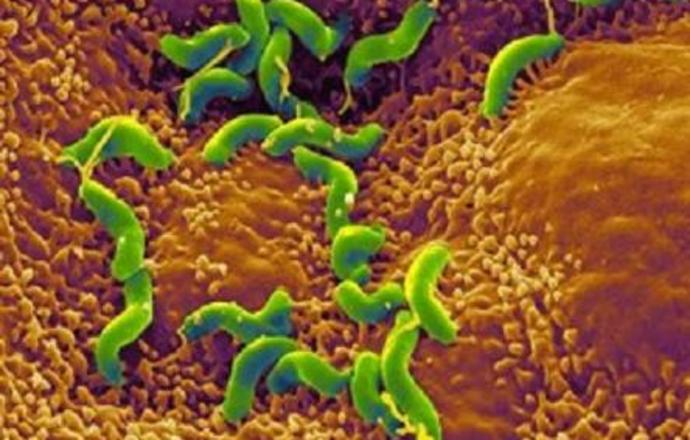 Szczepionka przeciwko Helicobacter pylori- obiecujące badania na modelu mysim!